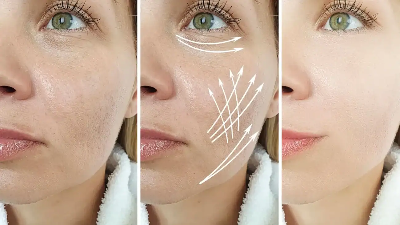 Can One Treatment Really Tackle More Than One Skin Concern Borehamwood?