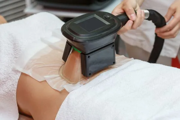 Image of person having fat freezing treatment to help weight gain Borehamwood