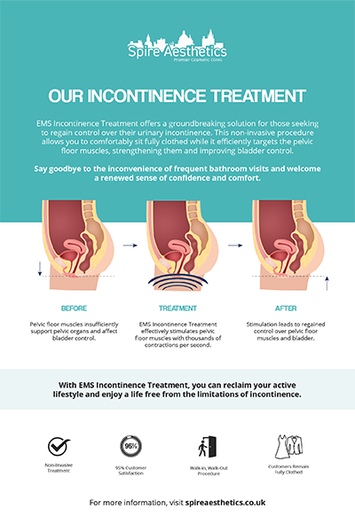 image to show how EMS treatment works for female urinary incontinence Borehamwood