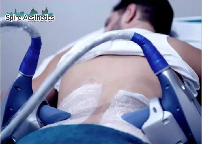 Man having fat freezing treatment done on love handles before a competitions Borehamwood to create a sculpted look.