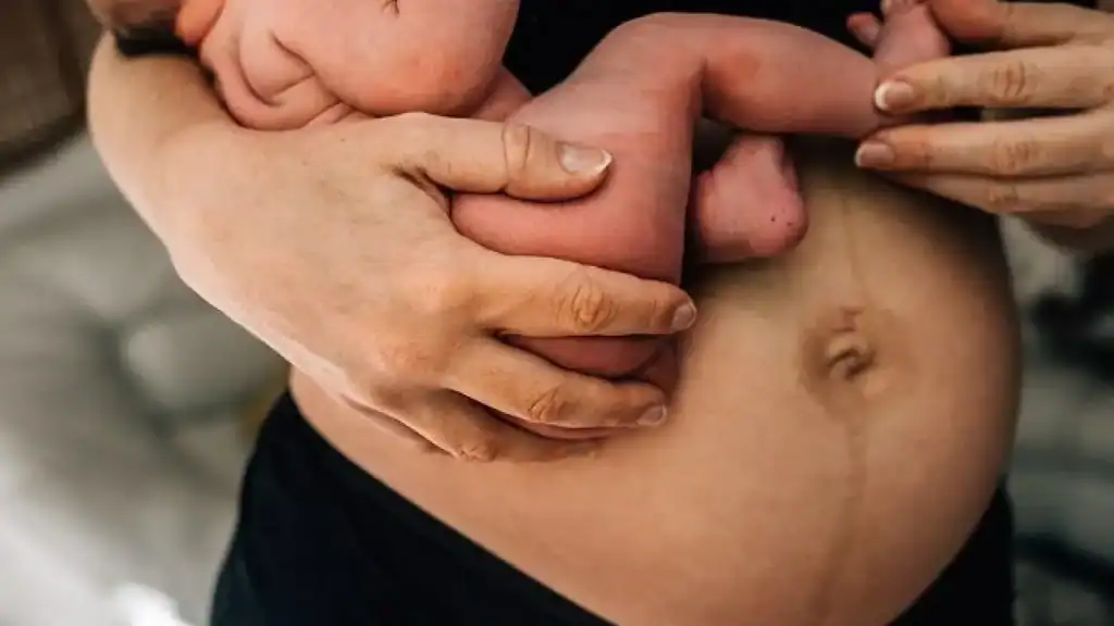 Why Is My Stomach Still Big After Pregnancy Borehamwood?