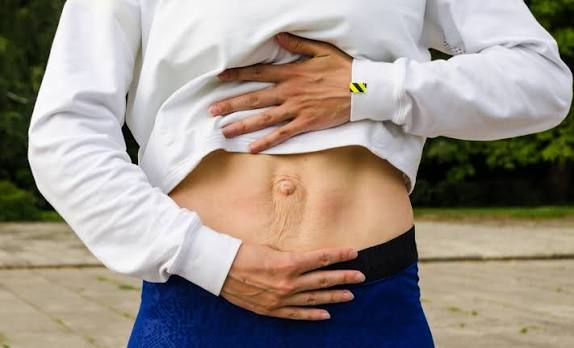 When Could Diastasis Recti Be the Missing Piece of the Puzzle Borehamwood?